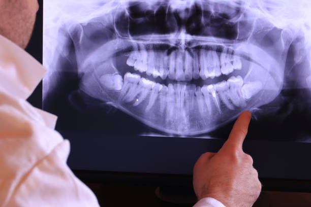 Best Urgent Dental Care for Toothache in Helena, OK